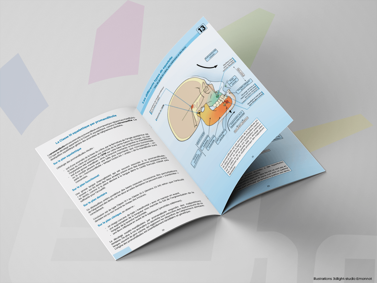 Illustration médicale