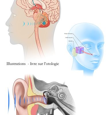 Illustrations médicales