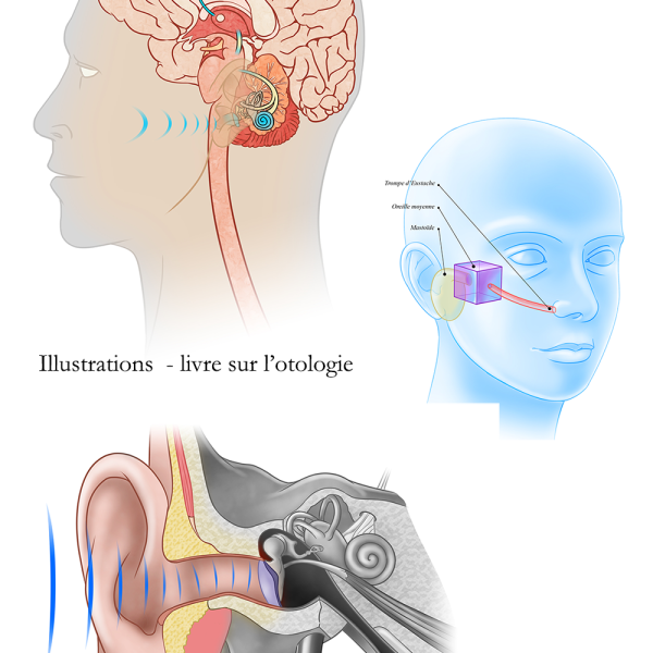 Illustrations médicales
